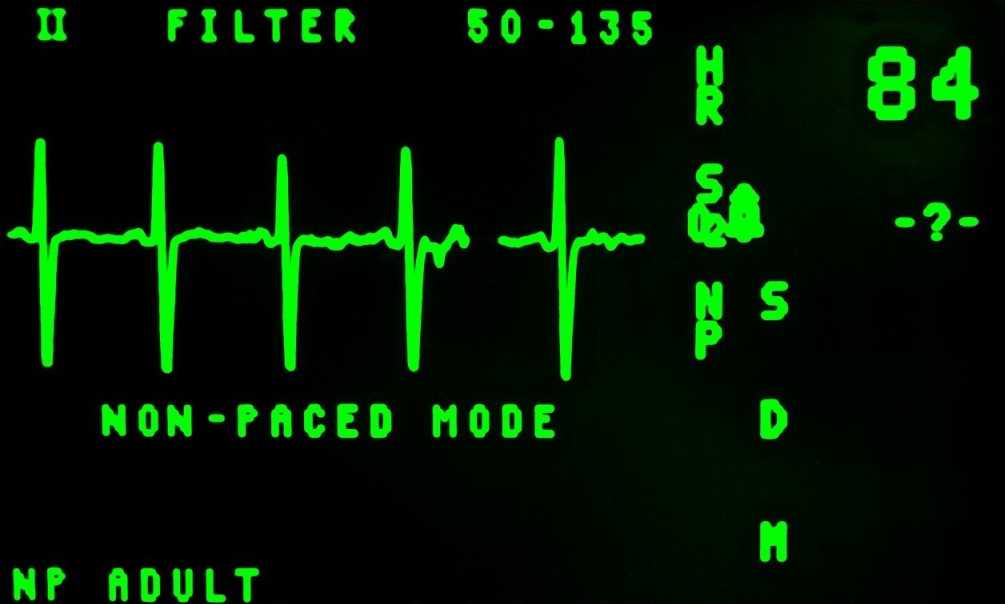 electrocardiogram pixlr